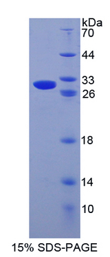 GZMB / Granzyme B Protein - Recombinant  Granzyme B By SDS-PAGE
