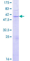 GZMH / Granzyme H Protein - 12.5% SDS-PAGE of human GZMH stained with Coomassie Blue