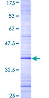 GZMH / Granzyme H Protein - 12.5% SDS-PAGE Stained with Coomassie Blue.