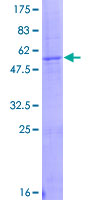GZMK / Granzyme K Protein - 12.5% SDS-PAGE of human GZMK stained with Coomassie Blue