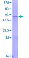 GZMK / Granzyme K Protein - 12.5% SDS-PAGE of human GZMK stained with Coomassie Blue