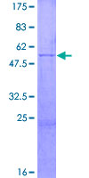 GZMM / Granzyme M Protein - 12.5% SDS-PAGE of human GZMM stained with Coomassie Blue
