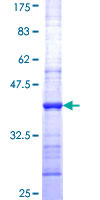 GZMM / Granzyme M Protein - 12.5% SDS-PAGE Stained with Coomassie Blue.