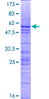 H1F0 Protein - 12.5% SDS-PAGE of human H1F0 stained with Coomassie Blue