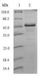 H1F0 Protein - (Tris-Glycine gel) Discontinuous SDS-PAGE (reduced) with 5% enrichment gel and 15% separation gel.
