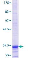 H1F0 Protein - 12.5% SDS-PAGE Stained with Coomassie Blue.