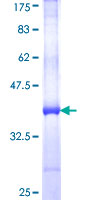 H2AFB2; H2AFB3 Protein - 12.5% SDS-PAGE Stained with Coomassie Blue.