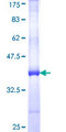 H2AFB2; H2AFB3 Protein - 12.5% SDS-PAGE Stained with Coomassie Blue.