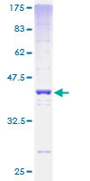 H2AFV Protein - 12.5% SDS-PAGE of human H2AFV stained with Coomassie Blue