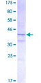 H2AFX / H2AX Protein - 12.5% SDS-PAGE of human H2AFX stained with Coomassie Blue