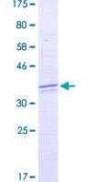 H2AFX / H2AX Protein - 12.5% SDS-PAGE Stained with Coomassie Blue.