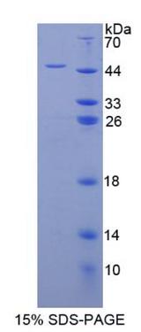 H2AFX / H2AX Protein - Recombinant H2A Histone Family, Member X By SDS-PAGE