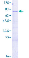 H2AFY / MACROH2A1 Protein - 12.5% SDS-PAGE of human H2AFY stained with Coomassie Blue