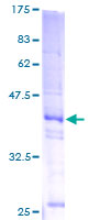 H2AFZ / H2A.z Protein - 12.5% SDS-PAGE of human H2AFZ stained with Coomassie Blue