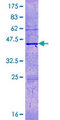 H3F3C Protein - 12.5% SDS-PAGE of human LOC440093 stained with Coomassie Blue