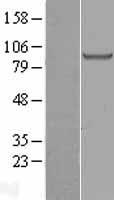 H6PD / G6PDH Protein - Western validation with an anti-DDK antibody * L: Control HEK293 lysate R: Over-expression lysate