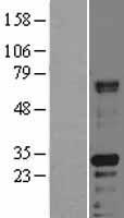 HABP2 Protein - Western validation with an anti-DDK antibody * L: Control HEK293 lysate R: Over-expression lysate