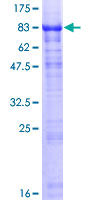 HABP2 Protein - 12.5% SDS-PAGE of human HABP2 stained with Coomassie Blue