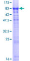 HABP2 Protein - 12.5% SDS-PAGE of human HABP2 stained with Coomassie Blue