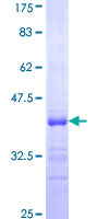 HABP2 Protein - 12.5% SDS-PAGE Stained with Coomassie Blue.
