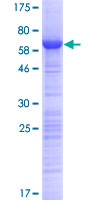 HABP4 Protein - 12.5% SDS-PAGE of human HABP4 stained with Coomassie Blue