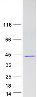 HABT1 / ABT1 Protein - Purified recombinant protein ABT1 was analyzed by SDS-PAGE gel and Coomassie Blue Staining