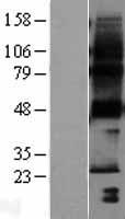 HACD1 / PTPLA Protein - Western validation with an anti-DDK antibody * L: Control HEK293 lysate R: Over-expression lysate
