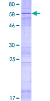 HACD3 / PTPLAD1 Protein - 12.5% SDS-PAGE of human PTPLAD1 stained with Coomassie Blue