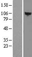 HACE1 Protein - Western validation with an anti-DDK antibody * L: Control HEK293 lysate R: Over-expression lysate