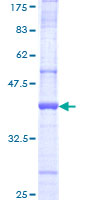 HACE1 Protein - 12.5% SDS-PAGE Stained with Coomassie Blue.