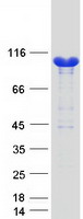 HACE1 Protein - Purified recombinant protein HACE1 was analyzed by SDS-PAGE gel and Coomassie Blue Staining