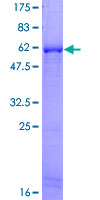 HADH Protein - 12.5% SDS-PAGE of human HADHSC stained with Coomassie Blue