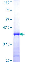 HADH Protein - 12.5% SDS-PAGE Stained with Coomassie Blue.