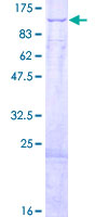 HADHA Protein - 12.5% SDS-PAGE of human HADHA stained with Coomassie Blue