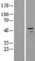 HADHB Protein - Western validation with an anti-DDK antibody * L: Control HEK293 lysate R: Over-expression lysate