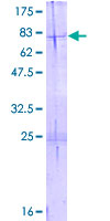 HADHB Protein - 12.5% SDS-PAGE of human HADHB stained with Coomassie Blue