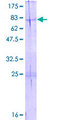 HADHB Protein - 12.5% SDS-PAGE of human HADHB stained with Coomassie Blue