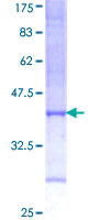 HADHB Protein - 12.5% SDS-PAGE Stained with Coomassie Blue.