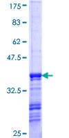 HAGH Protein - 12.5% SDS-PAGE Stained with Coomassie Blue.