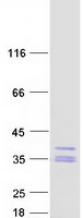 HAGH Protein - Purified recombinant protein HAGH was analyzed by SDS-PAGE gel and Coomassie Blue Staining