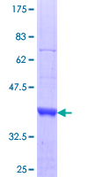 HAGHL Protein - 12.5% SDS-PAGE Stained with Coomassie Blue.