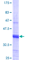 Hairless / HR Protein - 12.5% SDS-PAGE Stained with Coomassie Blue