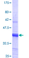 Hairless / HR Protein - 12.5% SDS-PAGE Stained with Coomassie Blue