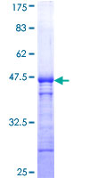 HAK / ALPK2 Protein - 12.5% SDS-PAGE Stained with Coomassie Blue.