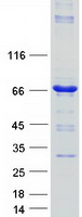 HAL / Histidine Ammonium Lyase Protein - Purified recombinant protein HAL was analyzed by SDS-PAGE gel and Coomassie Blue Staining