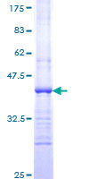 Hamartin / TSC1 Protein - 12.5% SDS-PAGE Stained with Coomassie Blue.
