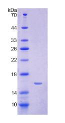 HAMP / Hepcidin Protein - Recombinant Hepcidin By SDS-PAGE
