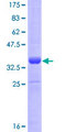 HAND1 Protein - 12.5% SDS-PAGE Stained with Coomassie Blue.