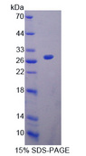 HAND1 Protein - Recombinant  Heart And Neural Crest Derivatives Expressed Protein 1 By SDS-PAGE