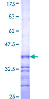 HAO1 Protein - 12.5% SDS-PAGE Stained with Coomassie Blue.